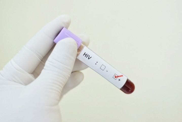 Estudo revela que 95% dos pacientes em tratamento contra HIV no Brasil não transmitem a doença